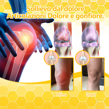 💥Aeehfeng™💥 Crema per il trattamento dell'artrite con veleno d'api e curcuma—specializzata in condizioni ortopediche e dolori articolari 🐝🐝